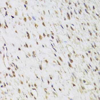 Immunohistochemistry: SEPHS1 Antibody [NBP3-35339] - Immunohistochemistry analysis of paraffin-embedded Human leiomyoma of uterus using SEPHS1 Rabbit pAb at dilution of 1:100 (40x lens). Microwave antigen retrieval performed with 0.01M PBS Buffer (pH 7.2) prior to IHC staining.