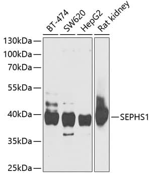 Western Blot: SEPHS1 Antibody [NBP3-35339] - Western Blot analysis of various lysates using SEPHS1 Rabbit pAb at 1:1000 dilution.&lt;br&gt;Secondary antibody: HRP-conjugated Goat anti-Rabbit IgG (H+L) at 1:10000 dilution.&lt;br&gt;Lysates/proteins: 25ug per lane.&lt;br&gt;Blocking buffer: 3% nonfat dry milk in TBST.&lt;br&gt;Detection: ECL Basic Kit.&lt;br&gt;Exposure time: 30s.