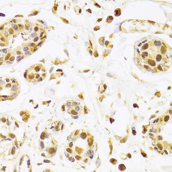 Immunohistochemistry: SEPHS1 Antibody [NBP3-35339] - Immunohistochemistry analysis of paraffin-embedded Human breast using SEPHS1 Rabbit pAb at dilution of 1:100 (40x lens). Microwave antigen retrieval performed with 0.01M PBS Buffer (pH 7.2) prior to IHC staining.