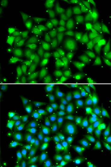 Immunocytochemistry/ Immunofluorescence: Suppressor of Fused Antibody [NBP3-35342] - Immunofluorescence analysis of MCF-7 cells using Suppressor of Fused Rabbit pAb. Secondary antibody: Cy3-conjugated Goat anti-Rabbit IgG (H+L) at 1:500 dilution. Blue: DAPI for nuclear staining.