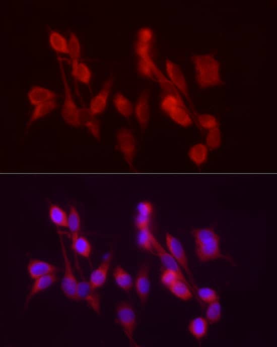 N/A alcohol dehydrogenase 5 Antibody