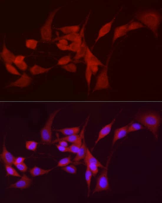 Immunocytochemistry/ Immunofluorescence: alcohol dehydrogenase 5 Antibody [NBP3-35343] - Immunofluorescence analysis of NIH/3T3 cells using alcohol dehydrogenase 5 Rabbit pAb at dilution of 1:50 (40x lens). Secondary antibody: Cy3-conjugated Goat anti-Rabbit IgG (H+L) at 1:500 dilution. Blue: DAPI for nuclear staining.