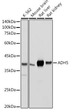 Western Blot: alcohol dehydrogenase 5 Antibody [NBP3-35343] - Western blot analysis of various lysates using alcohol dehydrogenase 5 Rabbit pAb at 1:500 dilution.Secondary antibody: HRP-conjugated Goat anti-Rabbit IgG (H+L) at 1:10000 dilution.Lysates/proteins: 25ug per lane.Blocking buffer: 3% nonfat dry milk in TBST.Detection: ECL Basic Kit.Exposure time: 1s.