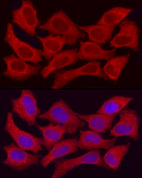 Immunocytochemistry/ Immunofluorescence: alcohol dehydrogenase 5 Antibody [NBP3-35343] - Immunofluorescence analysis of HeLa cells using alcohol dehydrogenase 5 Rabbit pAb at dilution of 1:50 (40x lens). Secondary antibody: Cy3-conjugated Goat anti-Rabbit IgG (H+L) at 1:500 dilution. Blue: DAPI for nuclear staining.