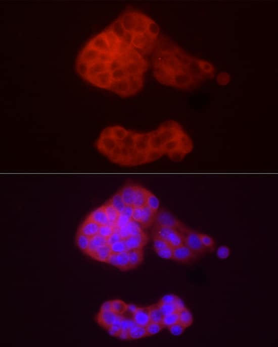 Immunocytochemistry/ Immunofluorescence: alcohol dehydrogenase 5 Antibody [NBP3-35343] - Immunofluorescence analysis of HepG2 cells using alcohol dehydrogenase 5 Rabbit pAb at dilution of 1:50 (40x lens). Secondary antibody: Cy3-conjugated Goat anti-Rabbit IgG (H+L) at 1:500 dilution. Blue: DAPI for nuclear staining.