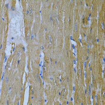 Immunohistochemistry: Adenylate Kinase 1 Antibody [NBP3-35344] - Immunohistochemistry analysis of paraffin-embedded Mouse heart using Adenylate Kinase 1 Rabbit pAb at dilution of 1:100 (40x lens). Microwave antigen retrieval performed with 0.01M PBS Buffer (pH 7.2) prior to IHC staining.