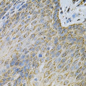 Immunohistochemistry: Adenylate Kinase 1 Antibody [NBP3-35344] - Immunohistochemistry analysis of paraffin-embedded Human esophagus using Adenylate Kinase 1 Rabbit pAb at dilution of 1:100 (40x lens). Microwave antigen retrieval performed with 0.01M PBS Buffer (pH 7.2) prior to IHC staining.