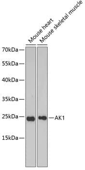 Western Blot: Adenylate Kinase 1 Antibody [NBP3-35344] - Western blot analysis of various lysates using Adenylate Kinase 1 Rabbit pAb at 1:1000 dilution.Secondary antibody: HRP-conjugated Goat anti-Rabbit IgG (H+L) at 1:10000 dilution.Lysates/proteins: 25ug per lane.Blocking buffer: 3% nonfat dry milk in TBST.