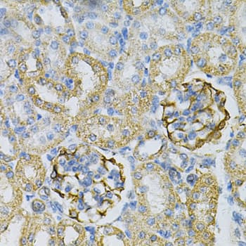 Immunohistochemistry: Adenylate Kinase 1 Antibody [NBP3-35344] - Immunohistochemistry analysis of paraffin-embedded Rat kidney using Adenylate Kinase 1 Rabbit pAb at dilution of 1:100 (40x lens). Microwave antigen retrieval performed with 0.01M PBS Buffer (pH 7.2) prior to IHC staining.