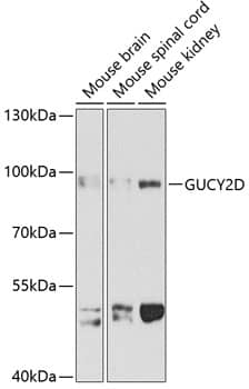 Western Blot: GUCY2D Antibody [NBP3-35345] - Western blot analysis of various lysates using GUCY2D Rabbit pAb at 1:1000 dilution.Secondary antibody: HRP-conjugated Goat anti-Rabbit IgG (H+L) at 1:10000 dilution.Lysates/proteins: 25ug per lane.Blocking buffer: 3% nonfat dry milk in TBST.Detection: ECL Basic Kit.Exposure time: 90s.