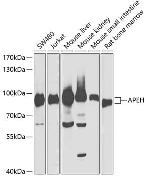 Western Blot: APEH Antibody [NBP3-35346] - Western blot analysis of various lysates using APEH Rabbit pAb at 1:1000 dilution.Secondary antibody: HRP-conjugated Goat anti-Rabbit IgG (H+L) at 1:10000 dilution.Lysates/proteins: 25ug per lane.Blocking buffer: 3% nonfat dry milk in TBST.Detection: ECL Basic Kit.Exposure time: 30s.