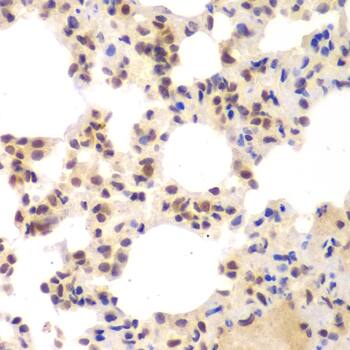 Immunohistochemistry: CKII alpha prime polypeptide Antibody [NBP3-35347] - Immunohistochemistry analysis of paraffin-embedded Mouse lung using CKII alpha prime polypeptide Rabbit pAb at dilution of 1:100 (40x lens). Microwave antigen retrieval performed with 0.01M PBS Buffer (pH 7.2) prior to IHC staining.