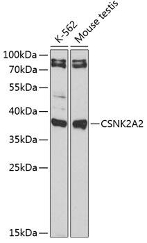 Western Blot: CKII alpha prime polypeptide Antibody [NBP3-35347] - Western blot analysis of various lysates using CKII alpha prime polypeptide Rabbit pAb at 1:1000 dilution.Secondary antibody: HRP-conjugated Goat anti-Rabbit IgG (H+L) at 1:10000 dilution.Lysates/proteins: 25ug per lane.Blocking buffer: 3% nonfat dry milk in TBST.