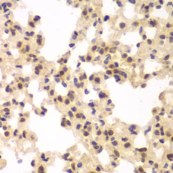 Immunohistochemistry: CKII alpha prime polypeptide Antibody [NBP3-35347] - Immunohistochemistry analysis of paraffin-embedded Rat lung using CKII alpha prime polypeptide Rabbit pAb at dilution of 1:100 (40x lens). Microwave antigen retrieval performed with 0.01M PBS Buffer (pH 7.2) prior to IHC staining.