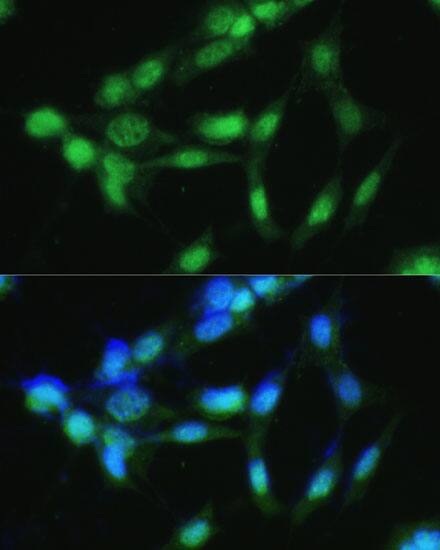 Immunocytochemistry/ Immunofluorescence: CKII alpha prime polypeptide Antibody [NBP3-35347] - Immunofluorescence analysis of NIH-3T3 cells using CKII alpha prime polypeptide Rabbit pAb at dilution of 1:100 (40x lens). Secondary antibody: Cy3-conjugated Goat anti-Rabbit IgG (H+L) at 1:500 dilution. Blue: DAPI for nuclear staining.