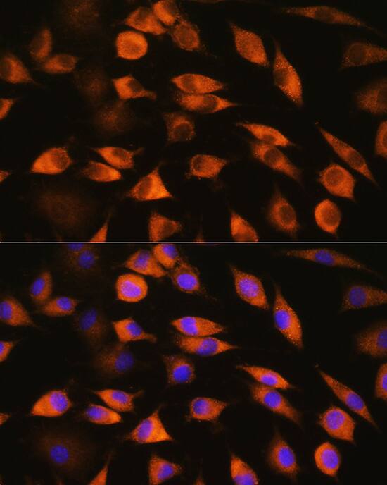 Immunocytochemistry/ Immunofluorescence CYP51A1 Antibody - BSA Free
