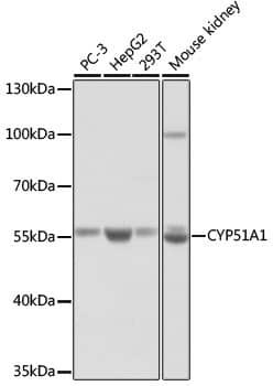 Western Blot: CYP51A1 Antibody [NBP3-35348] - Western blot analysis of various lysates using CYP51A1 Rabbit pAb at 1:1000 dilution.Secondary antibody: HRP-conjugated Goat anti-Rabbit IgG (H+L) at 1:10000 dilution.Lysates/proteins: 25ug per lane.Blocking buffer: 3% nonfat dry milk in TBST.Detection: ECL Basic Kit.Exposure time: 60s.