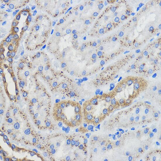 Immunohistochemistry: CYP51A1 Antibody [NBP3-35348] - Immunohistochemistry analysis of paraffin-embedded Rat kidney using CYP51A1 Rabbit pAb at dilution of 1:50 (40x lens). Microwave antigen retrieval performed with 0.01M PBS Buffer (pH 7.2) prior to IHC staining.