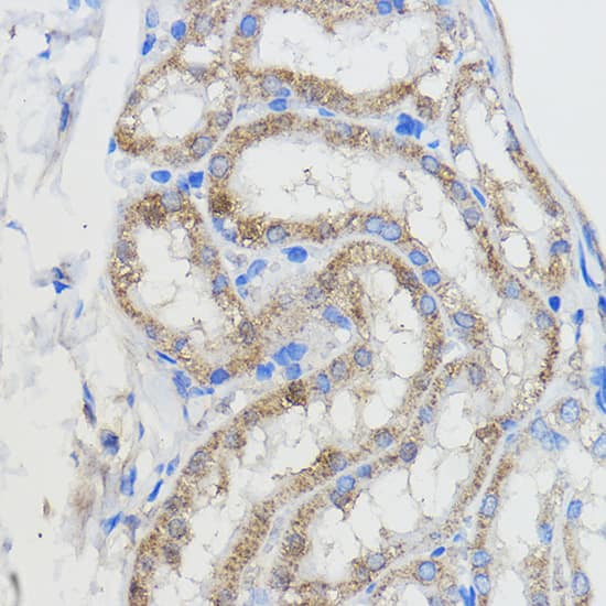 Immunohistochemistry: CYP51A1 Antibody [NBP3-35348] - Immunohistochemistry analysis of paraffin-embedded Mouse kidney using CYP51A1 Rabbit pAb at dilution of 1:50 (40x lens). Microwave antigen retrieval performed with 0.01M PBS Buffer (pH 7.2) prior to IHC staining.