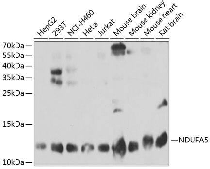 Western Blot: NDUFA5 Antibody [NBP3-35350] - Western blot analysis of various lysates using NDUFA5 Rabbit pAb at 1:1000 dilution.Secondary antibody: HRP-conjugated Goat anti-Rabbit IgG (H+L) at 1:10000 dilution.Lysates/proteins: 25ug per lane.Blocking buffer: 3% nonfat dry milk in TBST.Detection: ECL Basic Kit.Exposure time: 60s.