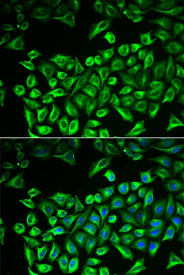 Immunocytochemistry/ Immunofluorescence: Hyaluronan Synthase 3/HAS3 Antibody [NBP3-35352] - Immunofluorescence analysis of A549 cells using Hyaluronan Synthase 3/HAS3 Rabbit pAb. Secondary antibody: Cy3-conjugated Goat anti-Rabbit IgG (H+L) at 1:500 dilution. Blue: DAPI for nuclear staining.