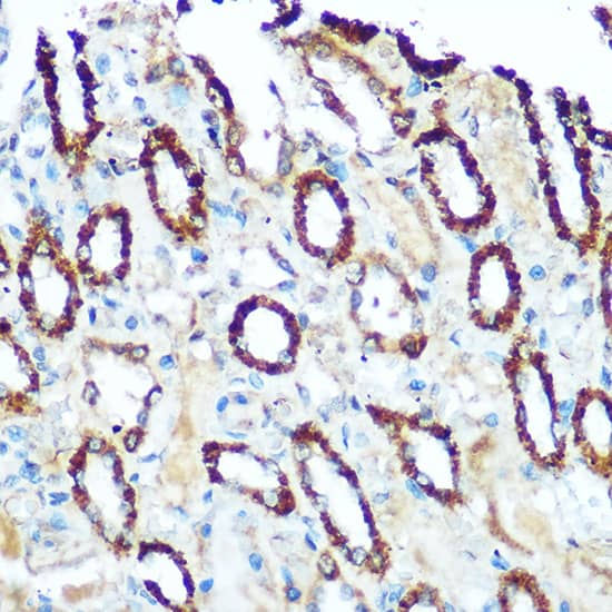 Immunohistochemistry: Ndufs4 Antibody [NBP3-35354] - Immunohistochemistry analysis of paraffin-embedded Rat kidney using Ndufs4 Rabbit pAb at dilution of 1:100 (40x lens). Microwave antigen retrieval performed with 0.01M Tris/EDTA Buffer (pH 9.0) prior to IHC staining.