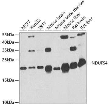 Western Blot: Ndufs4 Antibody [NBP3-35354] - Western blot analysis of various lysates using Ndufs4 Rabbit pAb at 1:1000 dilution.Secondary antibody: HRP-conjugated Goat anti-Rabbit IgG (H+L) at 1:10000 dilution.Lysates/proteins: 25ug per lane.Blocking buffer: 3% nonfat dry milk in TBST.Detection: ECL Basic Kit.Exposure time: 60s.