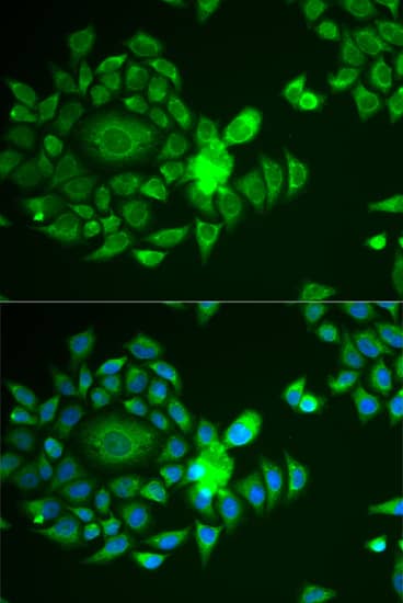 Immunocytochemistry/ Immunofluorescence: Ndufs4 Antibody [NBP3-35354] - Immunofluorescence analysis of U2OS cells using Ndufs4 Rabbit pAb. Secondary antibody: Cy3-conjugated Goat anti-Rabbit IgG (H+L) at 1:500 dilution. Blue: DAPI for nuclear staining.