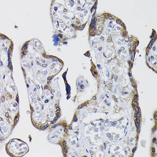 Immunohistochemistry Protein Phosphatase 1 beta Antibody