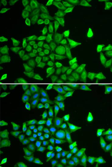 Immunocytochemistry/ Immunofluorescence: Proteasome 20S alpha 6 Antibody [NBP3-35356] - Immunofluorescence analysis of MCF-7 cells using Proteasome 20S alpha 6 Rabbit pAb. Secondary antibody: Cy3-conjugated Goat anti-Rabbit IgG (H+L) at 1:500 dilution. Blue: DAPI for nuclear staining.