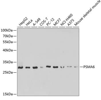 Western Blot: Proteasome 20S alpha 6 Antibody [NBP3-35356] - Western blot analysis of various lysates using Proteasome 20S alpha 6 Rabbit pAb at 1:1000 dilution.Secondary antibody: HRP-conjugated Goat anti-Rabbit IgG (H+L) at 1:10000 dilution.Lysates/proteins: 25ug per lane.Blocking buffer: 3% nonfat dry milk in TBST.