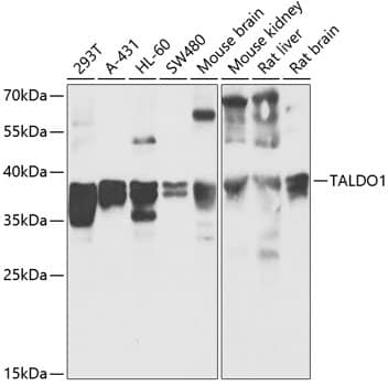 Western Blot: Transaldolase 1 Antibody [NBP3-35358] - Western blot analysis of various lysates using Transaldolase 1 Rabbit pAb at 1:1000 dilution.Secondary antibody: HRP-conjugated Goat anti-Rabbit IgG (H+L) at 1:10000 dilution.Lysates/proteins: 25ug per lane.Blocking buffer: 3% nonfat dry milk in TBST.Detection: ECL Basic Kit.Exposure time: 30s.