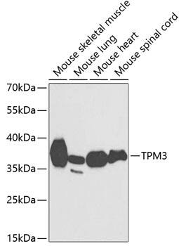 Western Blot: tropomyosin-3 Antibody [NBP3-35359] - Western blot analysis of various lysates using tropomyosin-3 Rabbit pAb at 1:1000 dilution.Secondary antibody: HRP-conjugated Goat anti-Rabbit IgG (H+L) at 1:10000 dilution.Lysates/proteins: 25ug per lane.Blocking buffer: 3% nonfat dry milk in TBST.