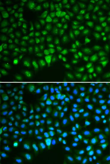 Immunocytochemistry/ Immunofluorescence DLG7/HURP Antibody