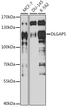 Western Blot: DLG7/HURP Antibody [NBP3-35362] - Western blot analysis of various lysates using DLG7/HURP Rabbit pAb at 1:1000 dilution.Secondary antibody: HRP-conjugated Goat anti-Rabbit IgG (H+L) at 1:10000 dilution.Lysates/proteins: 25ug per lane.Blocking buffer: 3% nonfat dry milk in TBST.Detection: ECL Basic Kit.Exposure time: 90s.