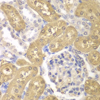 Immunohistochemistry: AKR1A1 Antibody [NBP3-35364] - Immunohistochemistry analysis of paraffin-embedded Rat kidney using AKR1A1 Rabbit pAb at dilution of 1:100 (40x lens). Microwave antigen retrieval performed with 0.01M PBS Buffer (pH 7.2) prior to IHC staining.