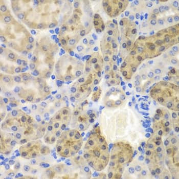 Immunohistochemistry: AKR1A1 Antibody [NBP3-35364] - Immunohistochemistry analysis of paraffin-embedded Mouse kidney using AKR1A1 Rabbit pAb at dilution of 1:100 (40x lens). Microwave antigen retrieval performed with 0.01M PBS Buffer (pH 7.2) prior to IHC staining.