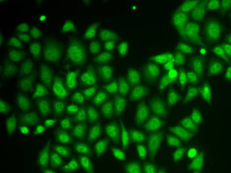 Immunocytochemistry/ Immunofluorescence: AKR1A1 Antibody [NBP3-35364] - Immunofluorescence analysis of HeLa cells using AKR1A1 Rabbit pAb.Secondary antibody: Cy3-conjugated Goat anti-Rabbit IgG (H+L) at 1:500 dilution.