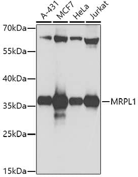 Western Blot: MRPL1 Antibody [NBP3-35365] - Western blot analysis of various lysates using MRPL1 Rabbit pAb at 1:1000 dilution.Secondary antibody: HRP-conjugated Goat anti-Rabbit IgG (H+L) at 1:10000 dilution.Lysates/proteins: 25ug per lane.Blocking buffer: 3% nonfat dry milk in TBST.Detection: ECL Basic Kit.Exposure time: 10s.