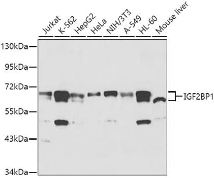 Western Blot: IGF2BP1 Antibody [NBP3-35366] - Western blot analysis of various lysates using IGF2BP1 Rabbit pAb at 1:1000 dilution.Secondary antibody: HRP-conjugated Goat anti-Rabbit IgG (H+L) at 1:10000 dilution.Lysates/proteins: 25ug per lane.Blocking buffer: 3% nonfat dry milk in TBST.