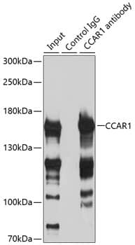 Immunoprecipitation: CCAR1 Antibody [NBP3-35368] - Immunoprecipitation analysis of 200 ug extracts of HeLa cells using 3 ug CCAR1 antibody. Western blot was performed from the immunoprecipitate using CCAR1 antibody at a dilution of 1:500.