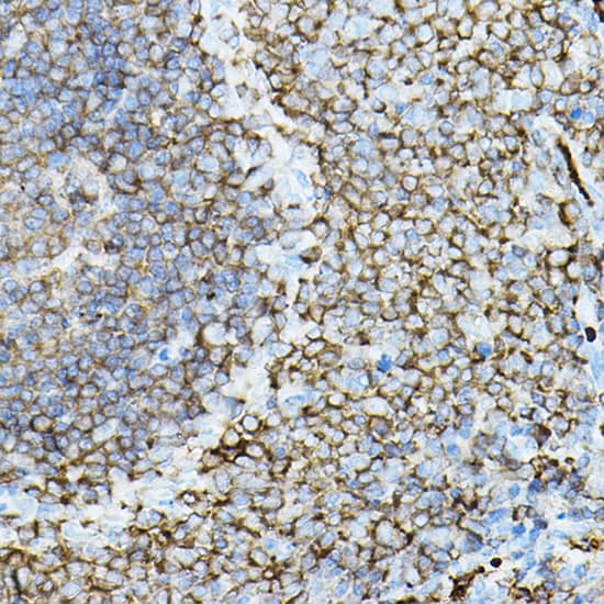 Immunohistochemistry: PKC beta Antibody [NBP3-35369] - Immunohistochemistry analysis of paraffin-embedded Rat spleen using PKC beta Rabbit pAb at dilution of 1:50 (40x lens). High pressure antigen retrieval performed with 0.01M Citrate Bufferr (pH 6.0) prior to IHC staining.