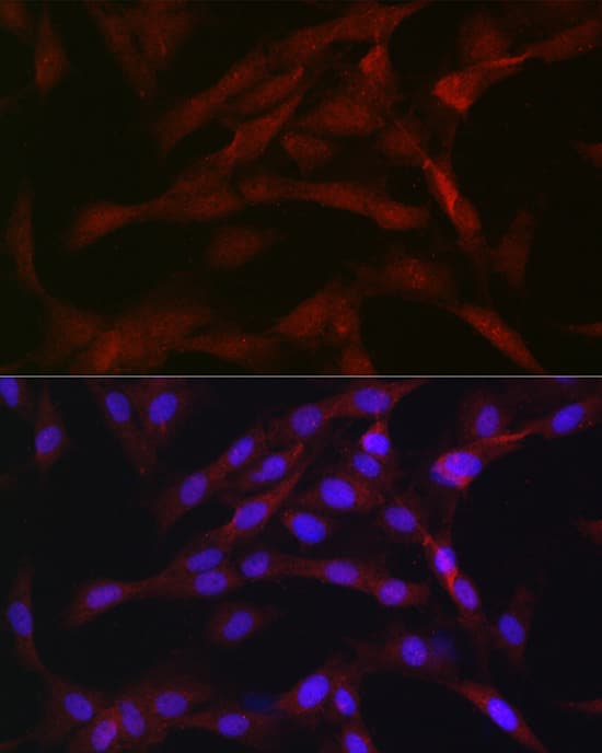 Immunocytochemistry/ Immunofluorescence: PKC beta Antibody [NBP3-35369] - Immunofluorescence analysis of C6 cells using PKC beta Rabbit pAb at dilution of 1:50 (40x lens). Secondary antibody: Cy3-conjugated Goat anti-Rabbit IgG (H+L) at 1:500 dilution. Blue: DAPI for nuclear staining.