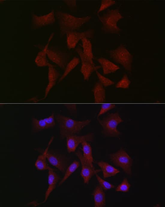 Immunocytochemistry/ Immunofluorescence PKC beta Antibody