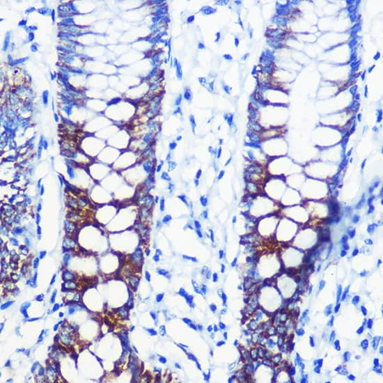 Immunohistochemistry: CPT1A Antibody [NBP3-35370] - Immunohistochemistry analysis of paraffin-embedded Human colon using CPT1A Rabbit pAb at dilution of 1:100 (40x lens). High pressure antigen retrieval performed with 0.01M Citrate Bufferr (pH 6.0) prior to IHC staining.