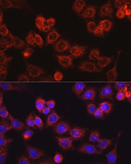 Immunocytochemistry/ Immunofluorescence: CPT1A Antibody [NBP3-35370] - Immunofluorescence analysis of Hep G2 cells using CPT1A Rabbit pAb at a dilution of 1:50 (40x lens). Secondary antibody:Cy3 Goat Anti-Rabbit IgG (H+L) at 1:500 dilution. Blue: DAPI for nuclear staining.