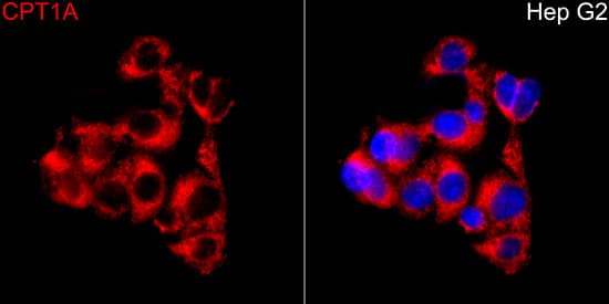 Immunocytochemistry/ Immunofluorescence: CPT1A Antibody [NBP3-35370] - Immunofluorescence analysis of Hep G2 cells using CPT1A Rabbit pAbat a dilution of 1:50 (40x lens). Secondary antibody:Cy3 Goat Anti-Rabbit IgG (H+L)at 1:500 dilution. Blue: DAPI for nuclear staining.