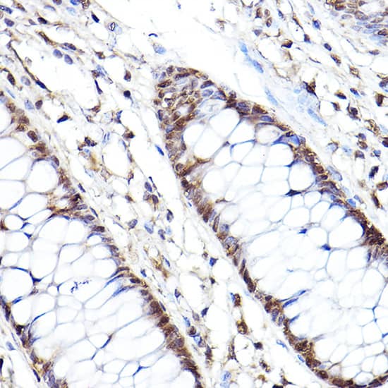 Immunohistochemistry: Proteasome 20S beta2 Antibody [NBP3-35371] - Immunohistochemistry analysis of paraffin-embedded Human colon using Proteasome 20S beta2 Rabbit pAb at dilution of 1:100 (40x lens). High pressure antigen retrieval performed with 0.01M Citrate Bufferr (pH 6.0) prior to IHC staining.