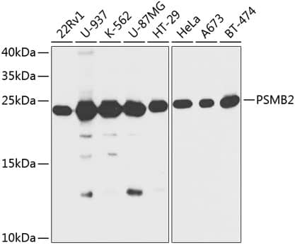 Western Blot: Proteasome 20S beta2 Antibody [NBP3-35371] - Western blot analysis of various lysates using Proteasome 20S beta2 Rabbit pAb at 1:1000 dilution.Secondary antibody: HRP-conjugated Goat anti-Rabbit IgG (H+L) at 1:10000 dilution.Lysates/proteins: 25ug per lane.Blocking buffer: 3% nonfat dry milk in TBST.Detection: ECL Basic Kit.Exposure time: 15s.