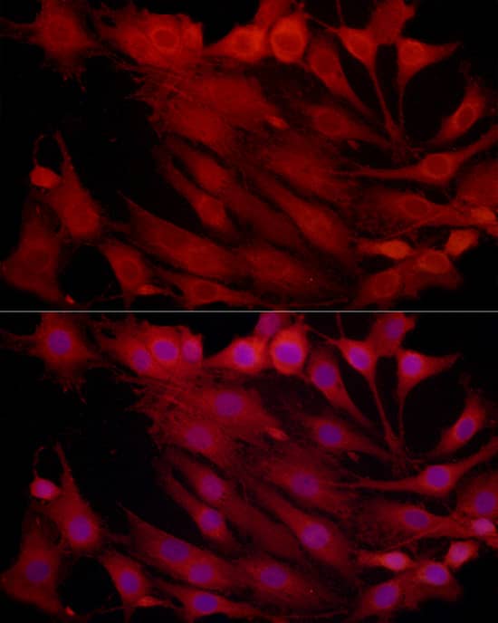 Immunocytochemistry/ Immunofluorescence: Proteasome 20S beta2 Antibody [NBP3-35371] - Immunofluorescence analysis of C6 cells using Proteasome 20S beta2 Rabbit pAb at dilution of 1:100 (40x lens). Secondary antibody: Cy3-conjugated Goat anti-Rabbit IgG (H+L) at 1:500 dilution. Blue: DAPI for nuclear staining.